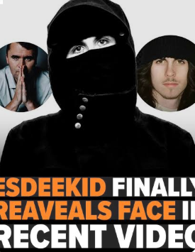 Why Does EsDeeKid Cover His Face 